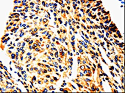 UTS2 Antibody