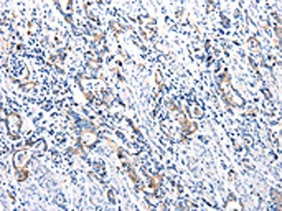 UTS2 Antibody