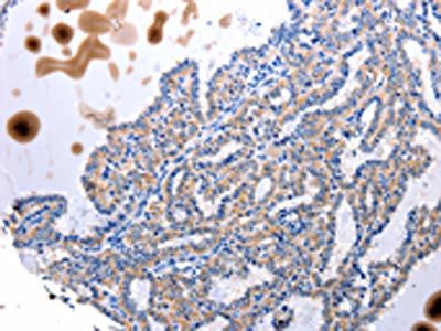 UTS2 Antibody