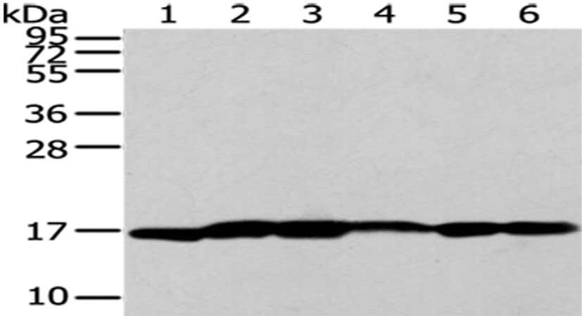 UTS2B antibody