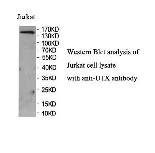 UTX Rabbit Polyclonal Antibody