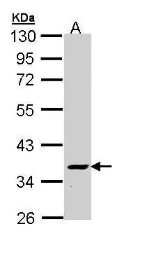 NUF2 component of NDC80 kinetochore complex Antibody