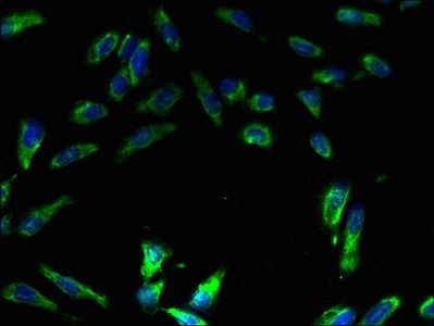 ATP6V1E1 Antibody