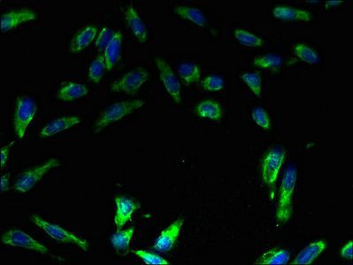 V-type proton ATPase subunit E 1 antibody