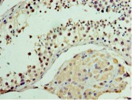 MON1A Antibody