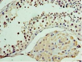 Vacuolar fusion protein MON1 homolog A antibody