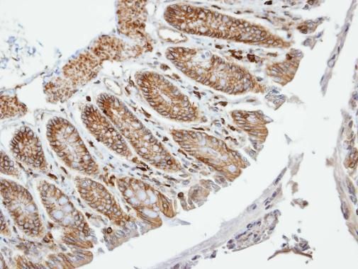 membrane palmitoylated protein 6 Antibody
