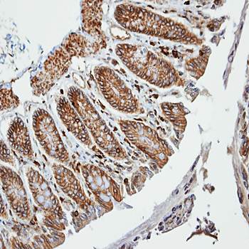 VAM1 Rabbit Polyclonal Antibody