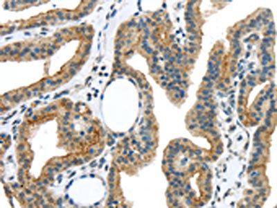 VAMP2 Antibody