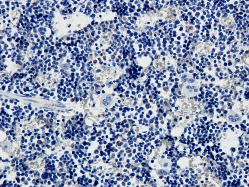 VAMP7 antibody