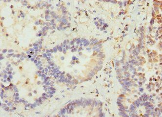 VANGL2 Antibody