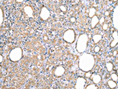 VAPA Antibody