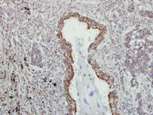 VAPA antibody [N1N3]