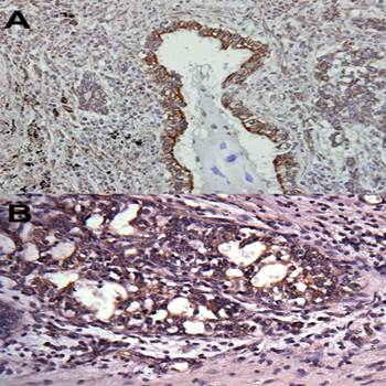 VAPA antibody