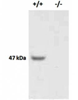 Vascular endothelial growth factor A Antibody