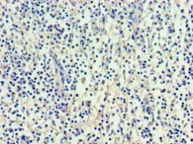 VEGFC Antibody