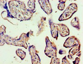 VEGFC Antibody