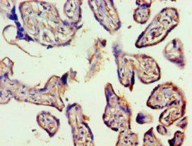 Vascular endothelial growth factor C antibody