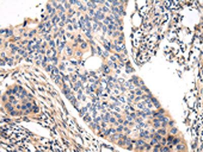 VASH1 Antibody