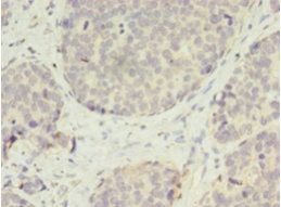VASH2 Antibody