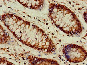 VASH2 Antibody