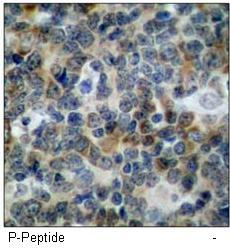 VASP (Phospho-Ser239) Antibody