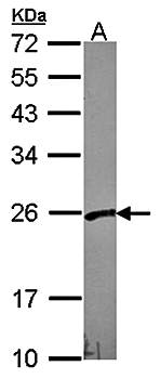 VBP1 Rabbit Polyclonal Antibody