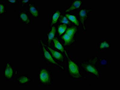 L1CAM Antibody