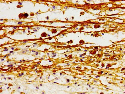 L1CAM Antibody