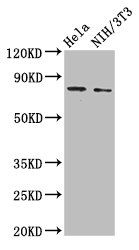 VCAM1 antibody