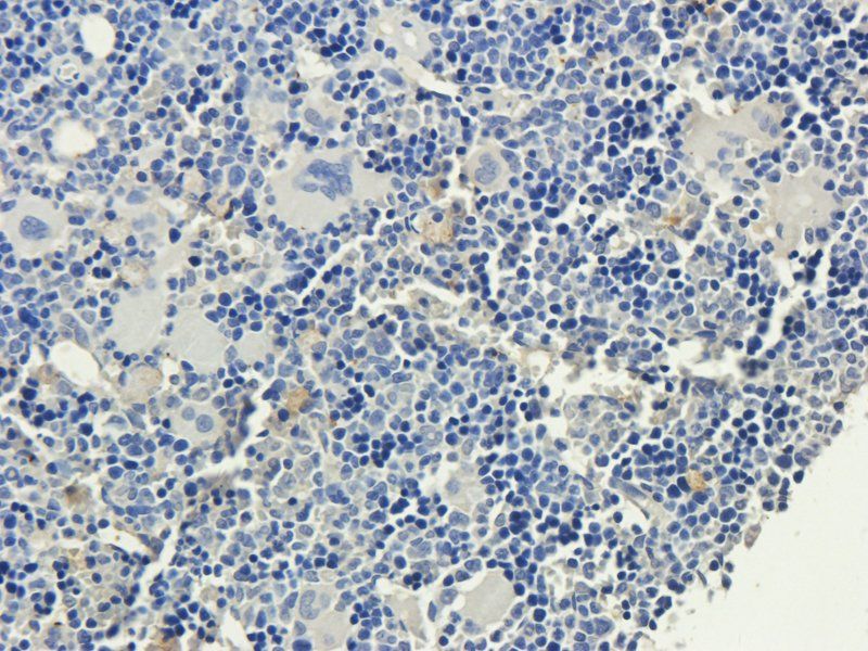 VCAM1 antibody