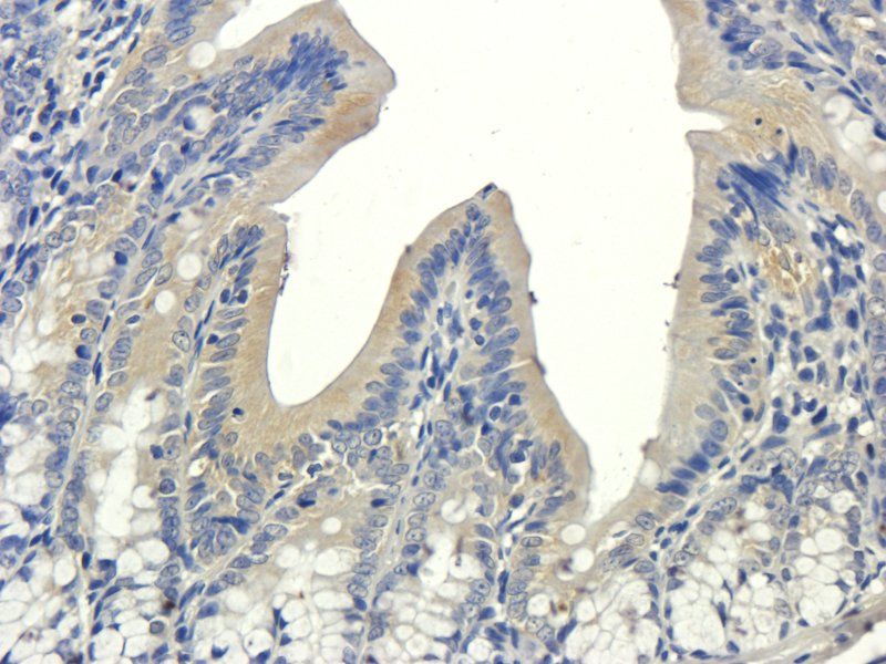 VCAM1 antibody