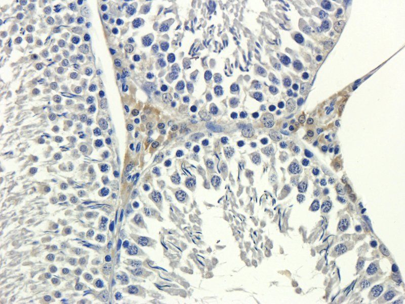 VCAM1 antibody