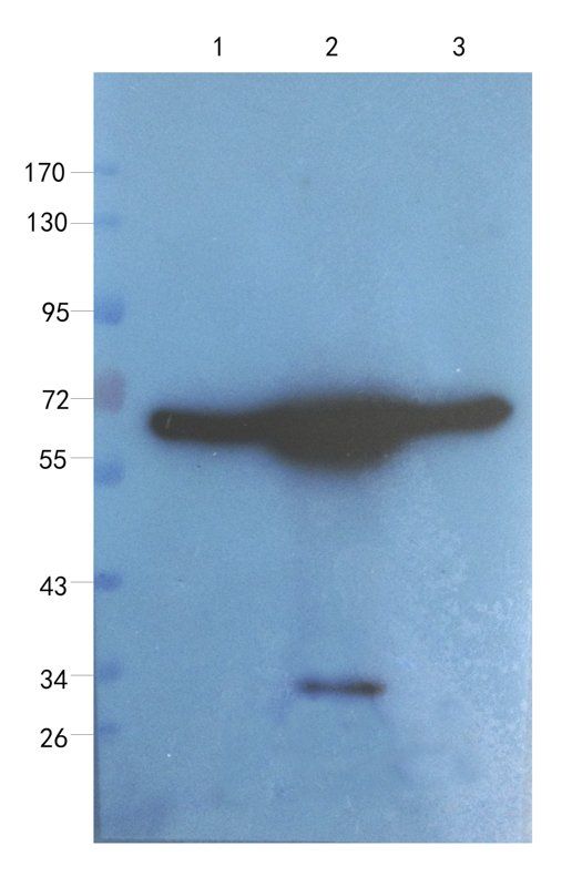 VCAM1 antibody