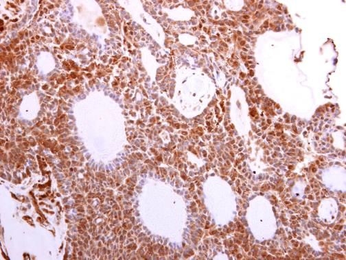 VCP antibody [N1N2], N-term