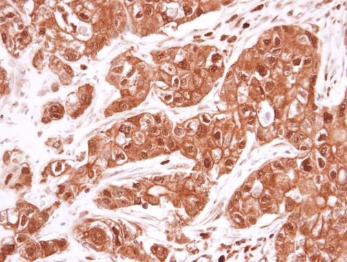 VCP antibody [N1N2], N-term