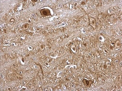 VCP antibody [N1N2], N-term