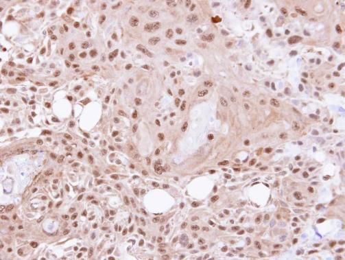 VCP antibody [N1N2], N-term