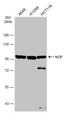 VCP antibody