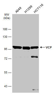 VCP antibody [N1N2], N-term