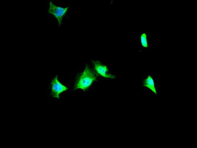 VCP Recombinant Monoclonal Antibody