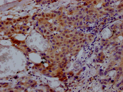 VCP Recombinant Monoclonal Antibody