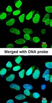 VCP(p97) antibody