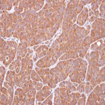 VCPIP1 antibody