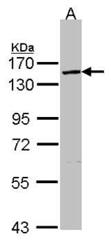 VCPIP1 Rabbit Polyclonal Antibody