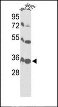VDAC1 antibody