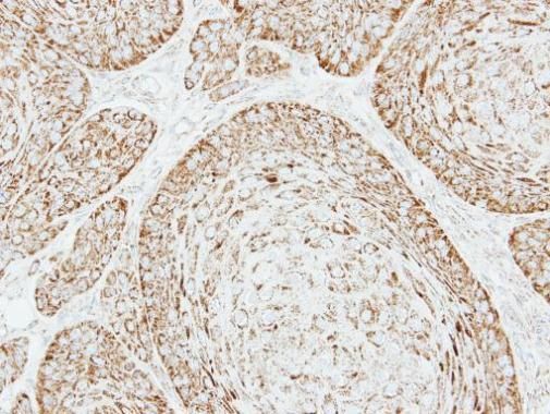 VDAC1 Rabbit Polyclonal Antibody