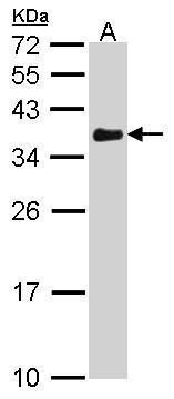 VDAC1 Rabbit Polyclonal Antibody