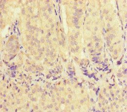 VDAC2 Antibody