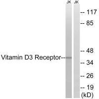 VDR (Ab-51) Antibody